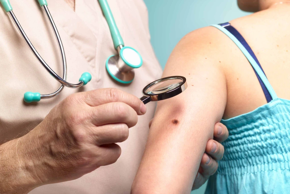 doctor examines skin